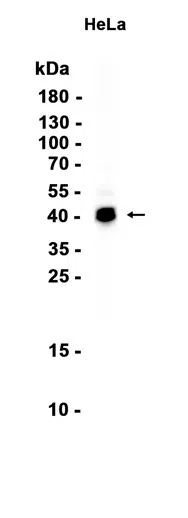 FOXF1 Rabbit Monoclonal Antibody - Size: 50µl