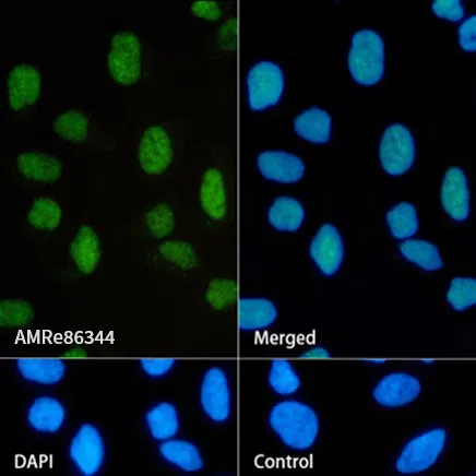 Dnmt1 Rabbit Monoclonal Antibody - Size: 100µl