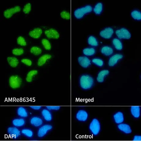 Sumo 1 Rabbit Monoclonal Antibody - Size: 50µl