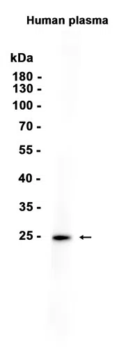 C Reactive Protein Rabbit Monoclonal Antibody - Size: 100µl