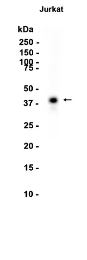 CD1c Rabbit Monoclonal Antibody - Size: 100µl