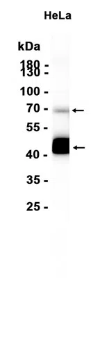 Mesothelin Rabbit Monoclonal Antibody - Size: 100µl