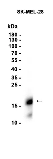 MelanA Rabbit Monoclonal Antibody - Size: 100µl