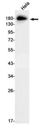 Phospho-ErbB 2 (Tyr1248)/ErbB 4 (Tyr1284) Rabbit Monoclonal Antibody - S
