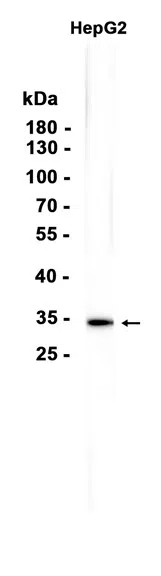ATP6V1E1 Rabbit Monoclonal Antibody - Size: 100µl