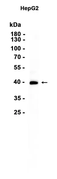 AIM2 Rabbit Monoclonal Antibody - Size: 50µl