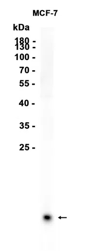 TFF1/pS2 Rabbit Monoclonal Antibody - Size: 50µl