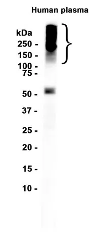 Lipoprotein a Rabbit Monoclonal Antibody - Size: 50µl
