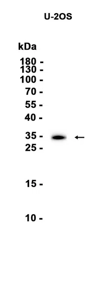 Cyclin D2 Rabbit Monoclonal Antibody - Size: 100µl