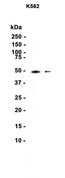 Casein Kinase 1 gamma 2 Rabbit Monoclonal Antibody - Size: 100µl
