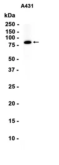 Plakophilin 1 Rabbit Monoclonal Antibody - Size: 50µl