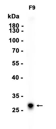 PCGF5 Rabbit Monoclonal Antibody - Size: 100µl