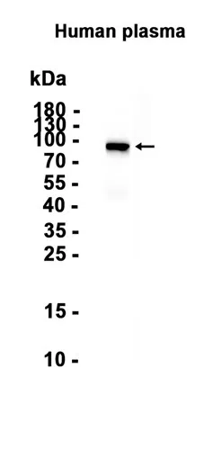 Factor XII Rabbit Monoclonal Antibody - Size: 50µl