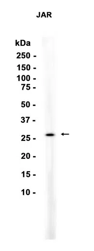 Lin28 Rabbit Monoclonal Antibody - Size: 100µl