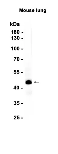 TTF1 Rabbit Monoclonal Antibody