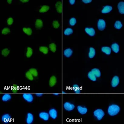 SA2 Rabbit Monoclonal Antibody - Size: 100µl