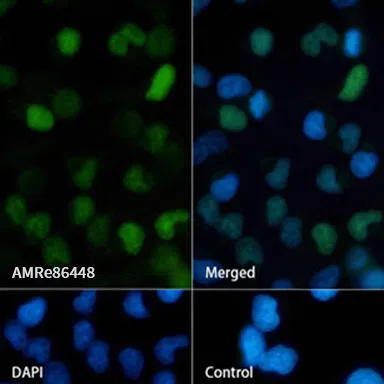 CDT1 Rabbit Monoclonal Antibody - Size: 100µl