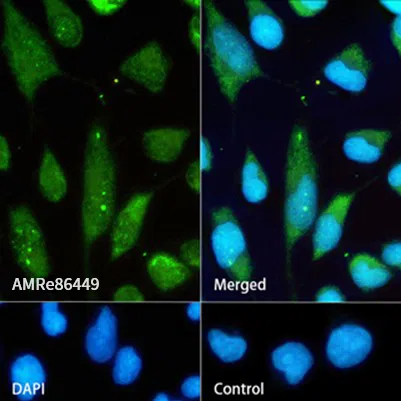 Hsp70 Rabbit Monoclonal Antibody - Size: 50µl