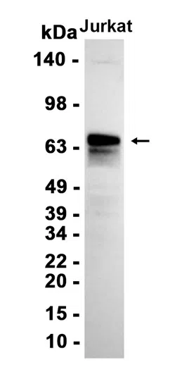 CD5 Rabbit Monoclonal Antibody - Size: 100µl