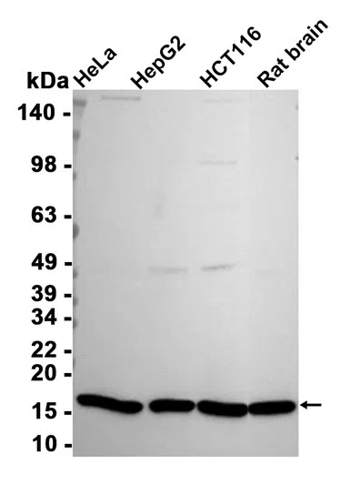 STMN1 Rabbit Monoclonal Antibody - Size: 50µl