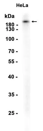 LRP5 Rabbit Monoclonal Antibody - Size: 50µl