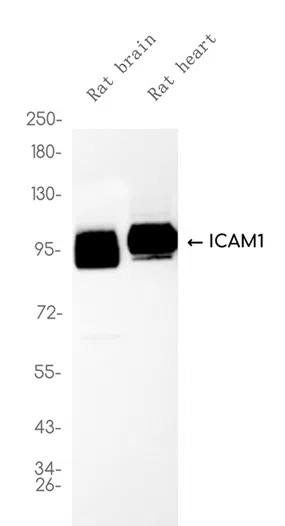 ICAM1 Rabbit Monoclonal Antibody - Size: 50µl