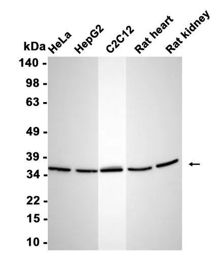 HtrA2/Omi Rabbit Monoclonal Antibody - Size: 50µl