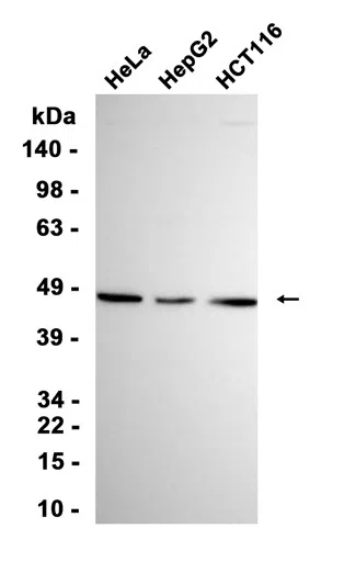 FEN1 Rabbit Monoclonal Antibody - Size: 50µl