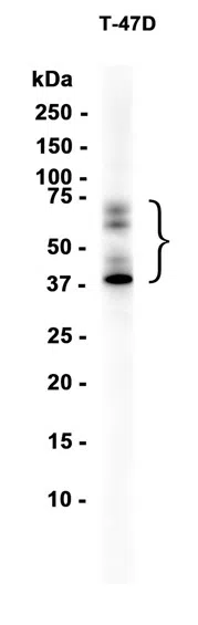 PVRL4 Rabbit Monoclonal Antibody - Size: 50µl