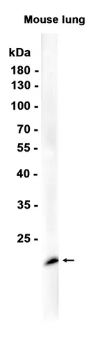 Lipocalin-2/NGAL Rabbit Monoclonal Antibody - Size: 50µl