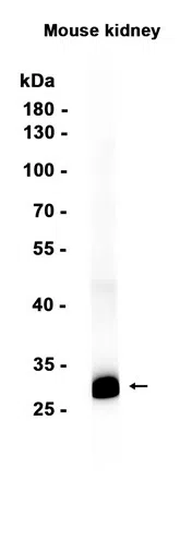 Calbindin Rabbit Monoclonal Antibody - Size: 100µl