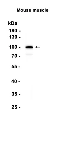 GPCR GPR49 Rabbit Monoclonal Antibody - Size: 50µl