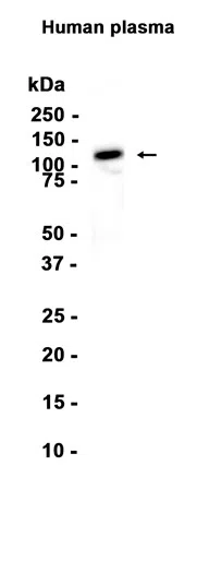 ITIH4 Rabbit Monoclonal Antibody - Size: 50µl