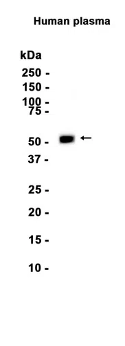 alpha 1 Antitrypsin Rabbit Monoclonal Antibody - Size: 100µl