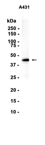 CCR8 Rabbit Monoclonal Antibody - Size: 100µl
