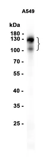 CEACAM1 Rabbit Monoclonal Antibody - Size: 50µl