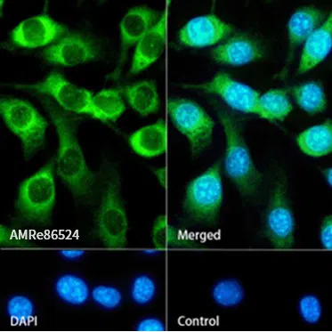 CNOT7 Rabbit Monoclonal Antibody - Size: 100µl