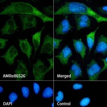 non-muscle Myosin IIA Rabbit Monoclonal Antibody - Size: 100µl