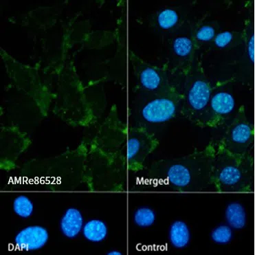 beta Catenin Rabbit Monoclonal Antibody - Size: 50µl