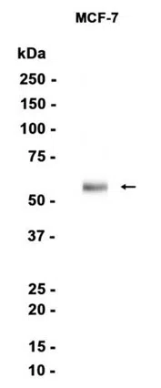 SGSH Rabbit Monoclonal Antibody - Size: 100µl