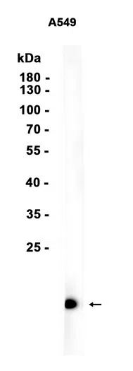 Uteroglobin Rabbit Monoclonal Antibody - Size: 50µl