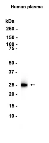 Serum Amyloid P Rabbit Monoclonal Antibody AMRe86540