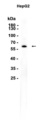 Monoamine Oxidase B Rabbit Monoclonal Antibody - Size: 50µl