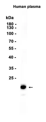 Apolipoprotein M Rabbit Monoclonal Antibody - Size: 100µl