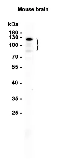 E-Cadherin Rabbit Monoclonal Antibody - Size: 100µl