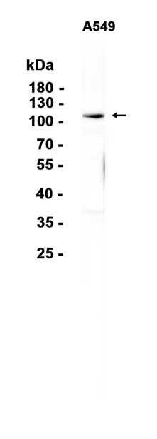 Protein Kinase D2 Rabbit Monoclonal Antibody - Size: 50µl