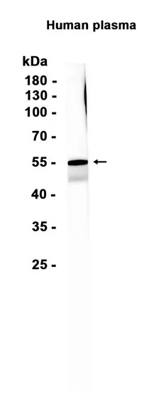 Angiotensinogen Rabbit Monoclonal Antibody - Size: 50µl