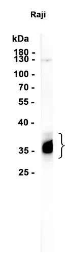 TACI Rabbit Monoclonal Antibody