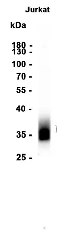 CD7 Rabbit Monoclonal Antibody