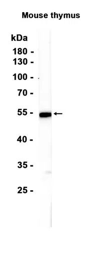 EGR2 Rabbit Monoclonal Antibody - Size: 50µl